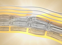 Enhanced Ceramide Lipid Complex